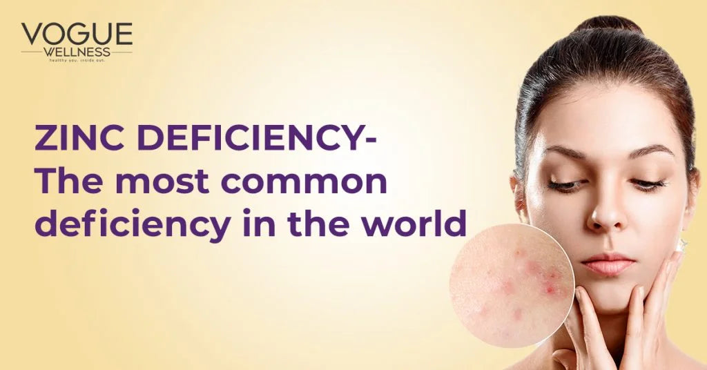 Zinc deficiency- the most common deficiency in the world – voguewellness.in