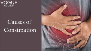 Causes of Constipation